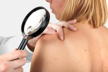 Hautkrebs Screening